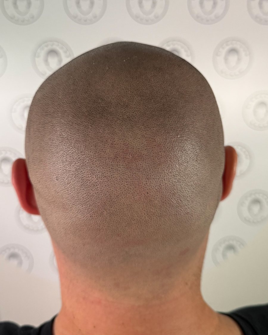 SMP back of head result, Adelaide